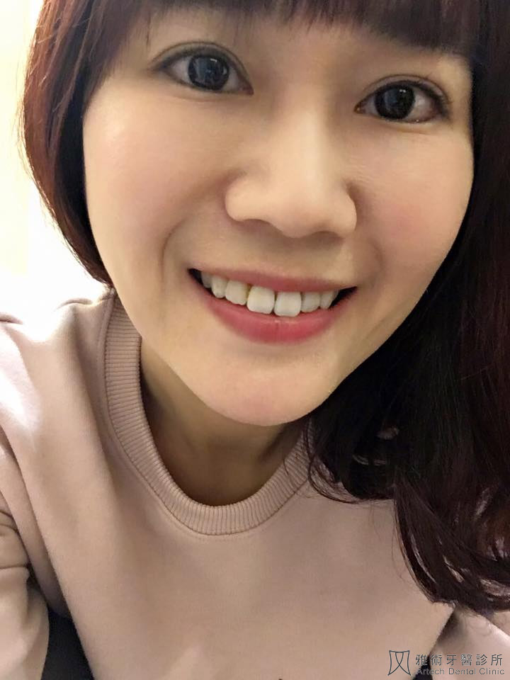 我的隱適美日記 Part 3