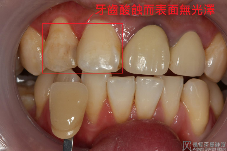 圖六-768x512