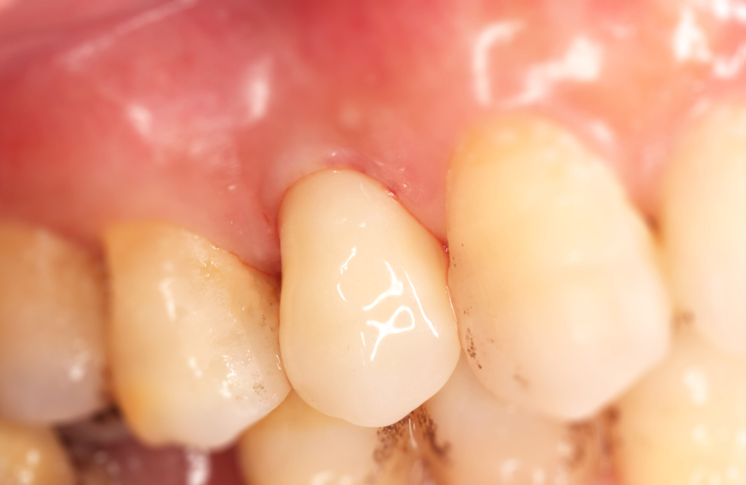 丁小姐3(翻轉版面)