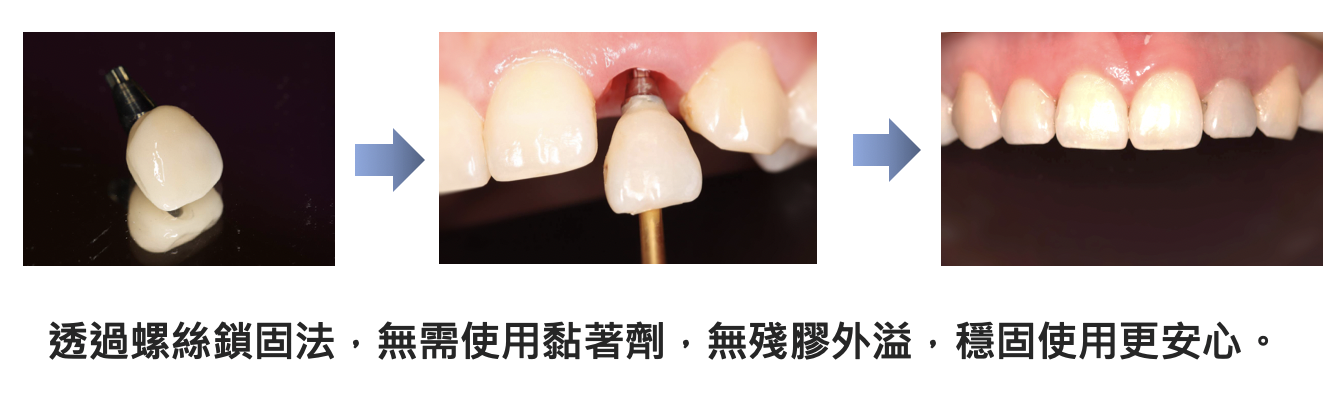 專文使用(流程圖)