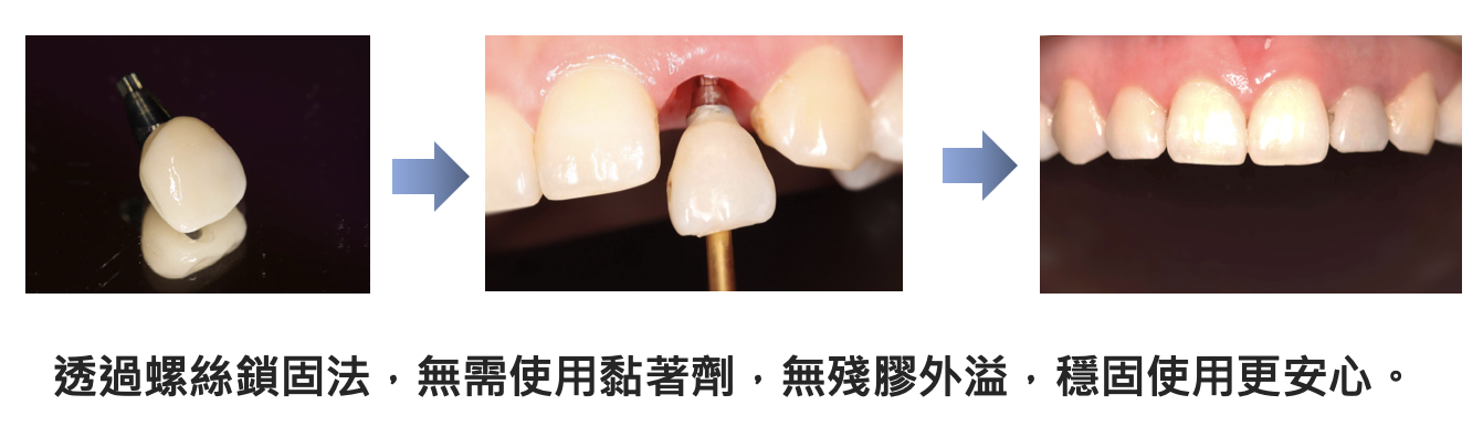 專文使用（流程圖）