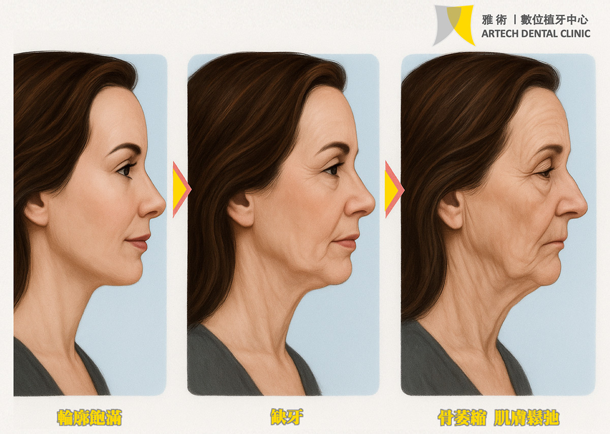外觀變化三階段
