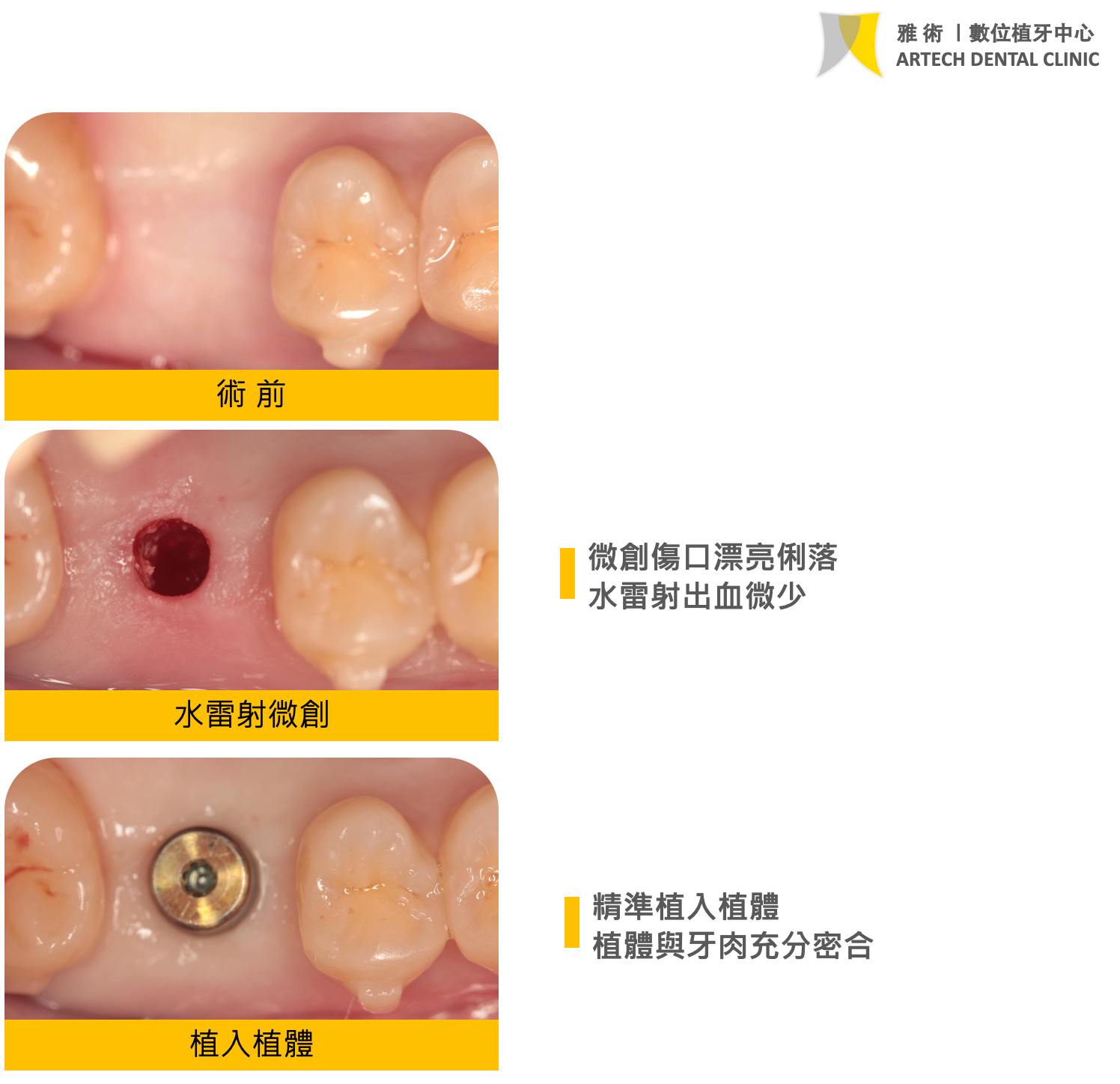 (更新版)這個案例中,