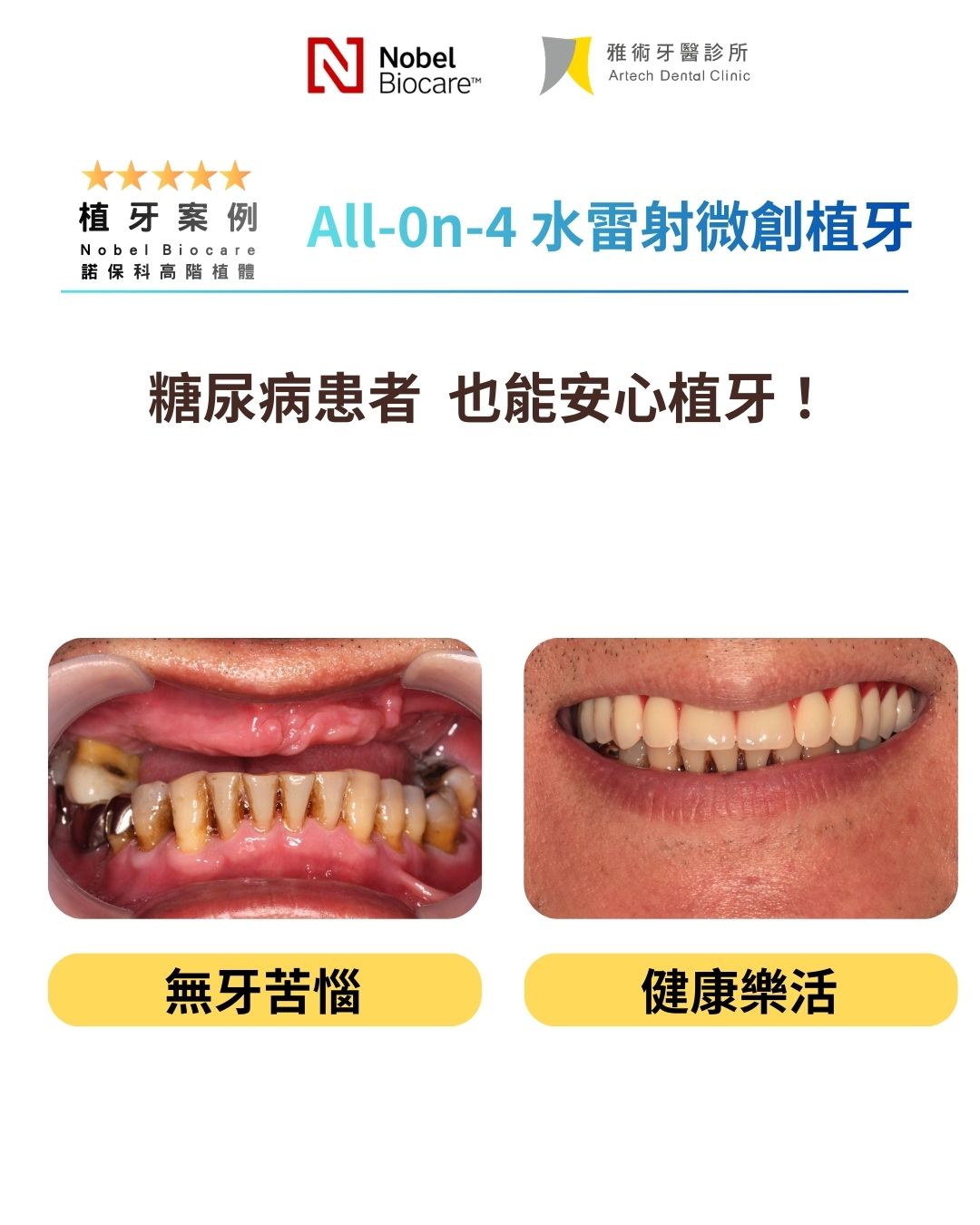 雅術｜IG動畫版 (45))